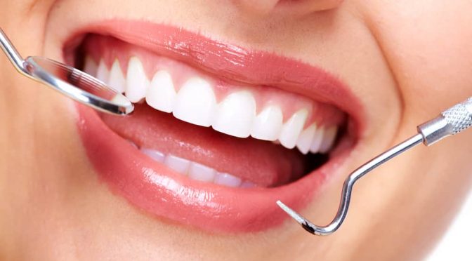 Cara Mudah Menjaga Kesehatan Gigi dan Mulut Agar Tetap Bersih