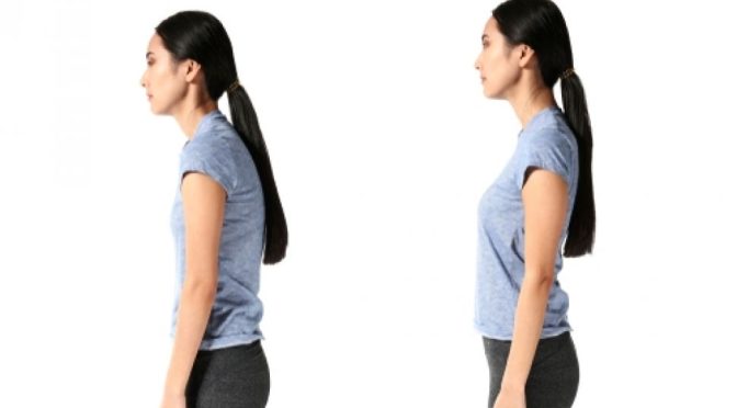Cara Memperbaiki Postur Tubuh agar Badan Tidak Bungkuk
